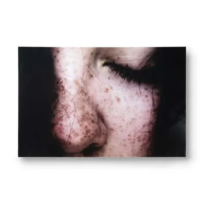 Plakat FRECKLES 100x66
